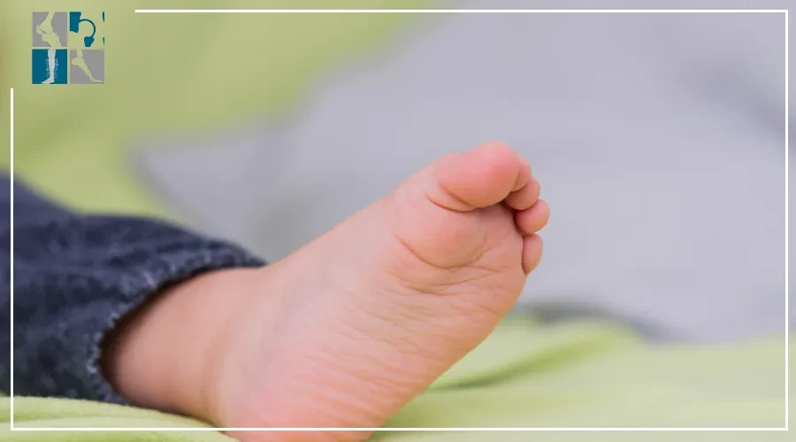 قدم مخلبية​: الأسباب والعلاج والوقاية للأطفال
